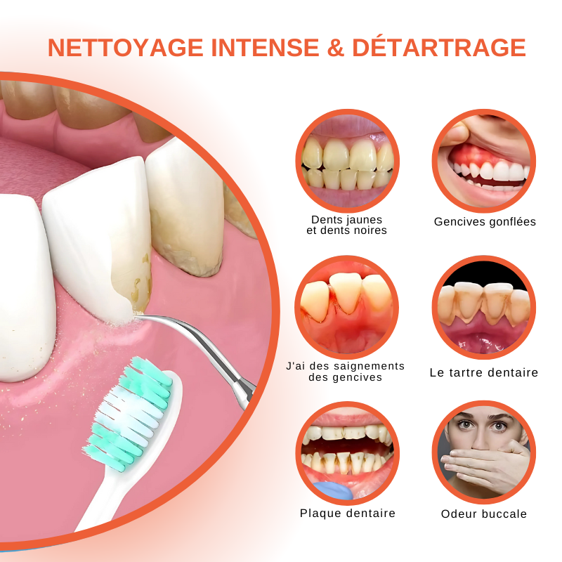 Détartreur Dentaire Ultrason