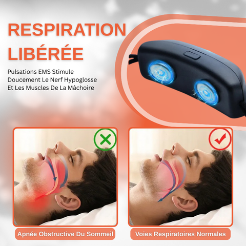 Appareil Anti Ronflement